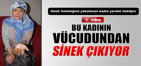 Vücudundan sinek çıkıyor