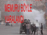 POLİS MEMURU BÖYLE YARALANDI